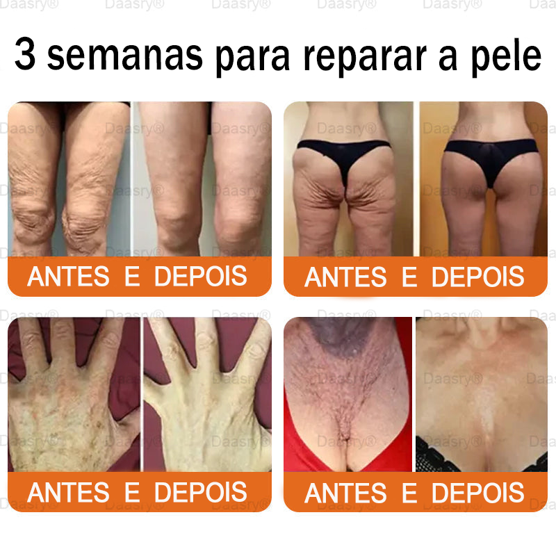 👨‍⚕️Certificado CE: Daasry® Creme Restaurador de Pele com Veneno de Abelha — Efeito Tipo Botox
