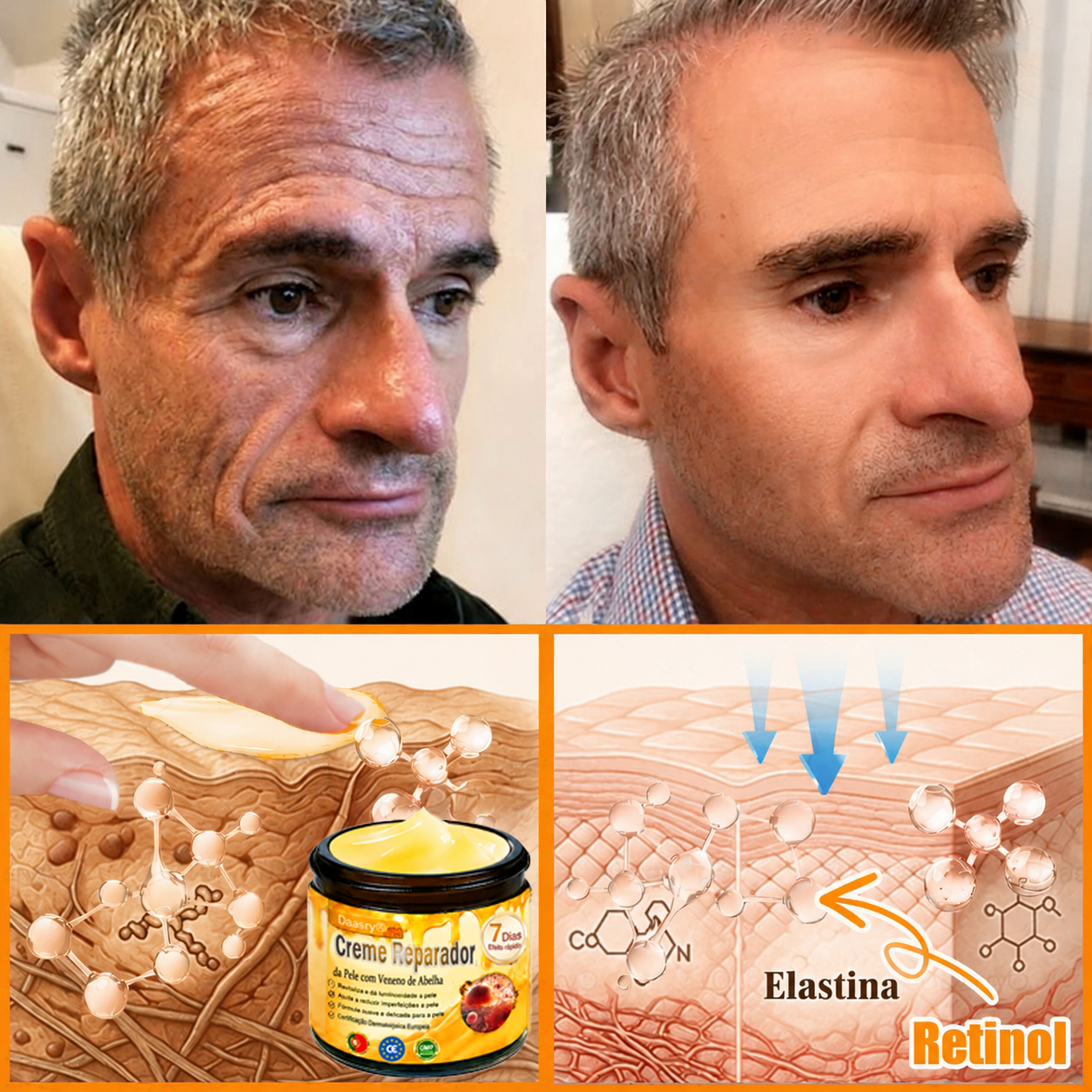 👨‍⚕️Certificado CE: Daasry® Creme Restaurador de Pele com Veneno de Abelha — Efeito Tipo Botox